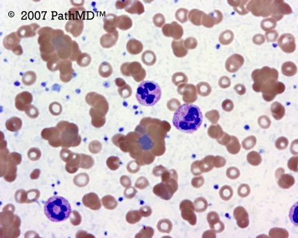 Peripheral Blood - Part 4, Question #4