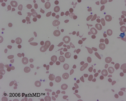 Peripheral Blood - Part 4, Question #5