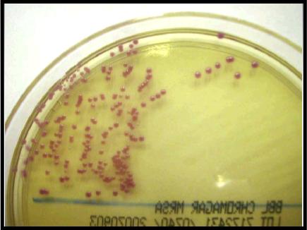 Microbiology - Part 2, Question #3